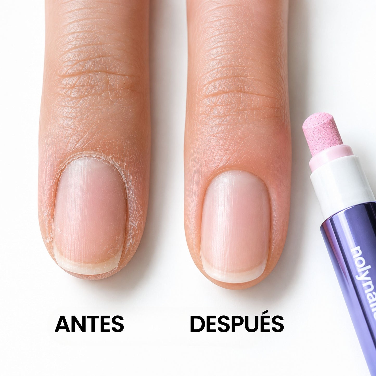 3-in-1 Nagelhautstift